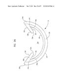 MECHANICAL METHOD AND APPARATUS FOR SEQUENTIAL TISSUE FASTENING diagram and image