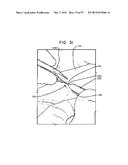 MECHANICAL METHOD AND APPARATUS FOR SEQUENTIAL TISSUE FASTENING diagram and image