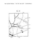 MECHANICAL METHOD AND APPARATUS FOR SEQUENTIAL TISSUE FASTENING diagram and image