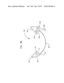 MECHANICAL METHOD AND APPARATUS FOR SEQUENTIAL TISSUE FASTENING diagram and image