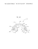 MECHANICAL METHOD AND APPARATUS FOR SEQUENTIAL TISSUE FASTENING diagram and image