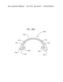 MECHANICAL METHOD AND APPARATUS FOR SEQUENTIAL TISSUE FASTENING diagram and image