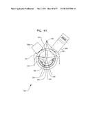 MECHANICAL METHOD AND APPARATUS FOR SEQUENTIAL TISSUE FASTENING diagram and image