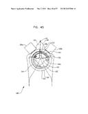 MECHANICAL METHOD AND APPARATUS FOR SEQUENTIAL TISSUE FASTENING diagram and image