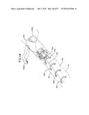 MECHANICAL METHOD AND APPARATUS FOR SEQUENTIAL TISSUE FASTENING diagram and image