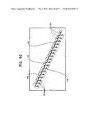 MECHANICAL METHOD AND APPARATUS FOR SEQUENTIAL TISSUE FASTENING diagram and image