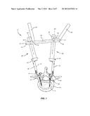 SPINAL CORRECTION SYSTEM AND METHOD diagram and image