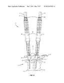 SPINAL CORRECTION SYSTEM AND METHOD diagram and image