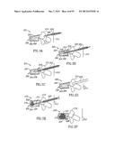 METHODS, MATERIALS AND APPARATUS FOR TREATING BONE AND OTHER TISSUE diagram and image