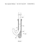 METHODS, MATERIALS AND APPARATUS FOR TREATING BONE AND OTHER TISSUE diagram and image