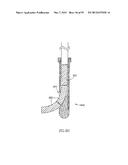 METHODS, MATERIALS AND APPARATUS FOR TREATING BONE AND OTHER TISSUE diagram and image