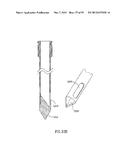 METHODS, MATERIALS AND APPARATUS FOR TREATING BONE AND OTHER TISSUE diagram and image