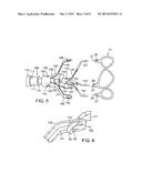 MAGNETIC RETAINING MECHANISMS FOR PROSTHETIC VALVES diagram and image