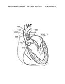 MAGNETIC RETAINING MECHANISMS FOR PROSTHETIC VALVES diagram and image