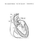 MAGNETIC RETAINING MECHANISMS FOR PROSTHETIC VALVES diagram and image