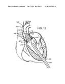 MAGNETIC RETAINING MECHANISMS FOR PROSTHETIC VALVES diagram and image