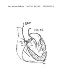 MAGNETIC RETAINING MECHANISMS FOR PROSTHETIC VALVES diagram and image