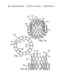 MAGNETIC RETAINING MECHANISMS FOR PROSTHETIC VALVES diagram and image