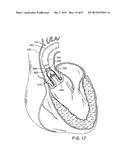 MAGNETIC RETAINING MECHANISMS FOR PROSTHETIC VALVES diagram and image