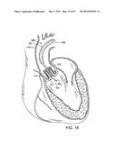 MAGNETIC RETAINING MECHANISMS FOR PROSTHETIC VALVES diagram and image