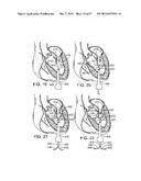 MAGNETIC RETAINING MECHANISMS FOR PROSTHETIC VALVES diagram and image