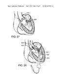 MAGNETIC RETAINING MECHANISMS FOR PROSTHETIC VALVES diagram and image