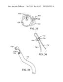 MAGNETIC RETAINING MECHANISMS FOR PROSTHETIC VALVES diagram and image