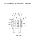 MAGNETIC RETAINING MECHANISMS FOR PROSTHETIC VALVES diagram and image