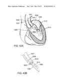 MAGNETIC RETAINING MECHANISMS FOR PROSTHETIC VALVES diagram and image