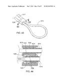 MAGNETIC RETAINING MECHANISMS FOR PROSTHETIC VALVES diagram and image