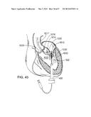 MAGNETIC RETAINING MECHANISMS FOR PROSTHETIC VALVES diagram and image