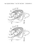 MAGNETIC RETAINING MECHANISMS FOR PROSTHETIC VALVES diagram and image