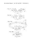 MAGNETIC RETAINING MECHANISMS FOR PROSTHETIC VALVES diagram and image