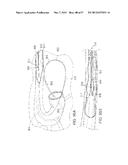 MAGNETIC RETAINING MECHANISMS FOR PROSTHETIC VALVES diagram and image