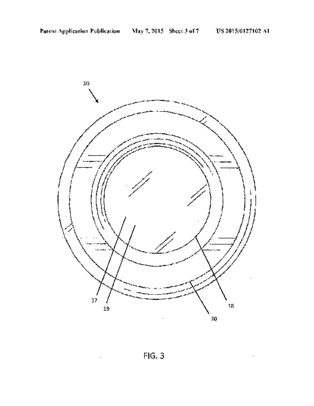 PROSTHETHIC CAPSULAR BAG AND METHOD OF INSERTING THE SAME - diagram, schematic, and image 04