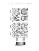 ADAPTABLE SURFACE FOR USE IN BEDS AND CHAIRS TO REDUCE OCCURRENCE OF     PRESSURE ULCERS diagram and image