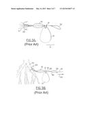 SPINNER FISHING LURE diagram and image