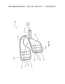 METHOD AND APPARATUS FOR ORAL FLOW THERAPY diagram and image