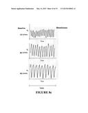 CONTROL OF FLOW AND/OR PRESSURE PROVIDED BY BREATHING APPARATUS diagram and image