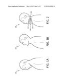 NECK EXTENSION DEVICE AND METHOD OF USE diagram and image