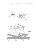 System for Transfer of Nanomembrane Elements with Improved Preservation of     Spatial Integrity diagram and image