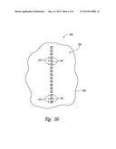 PACKAGED MICROELECTRONIC DEVICES AND METHODS FOR MANUFACTURING PACKAGED     MICROELECTRONIC DEVICES diagram and image