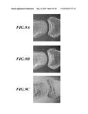 MEDICAL IMAGING SYSTEM AND MEDICAL IMAGE PROCESSING APPARATUS diagram and image