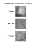 MEDICAL IMAGING SYSTEM AND MEDICAL IMAGE PROCESSING APPARATUS diagram and image