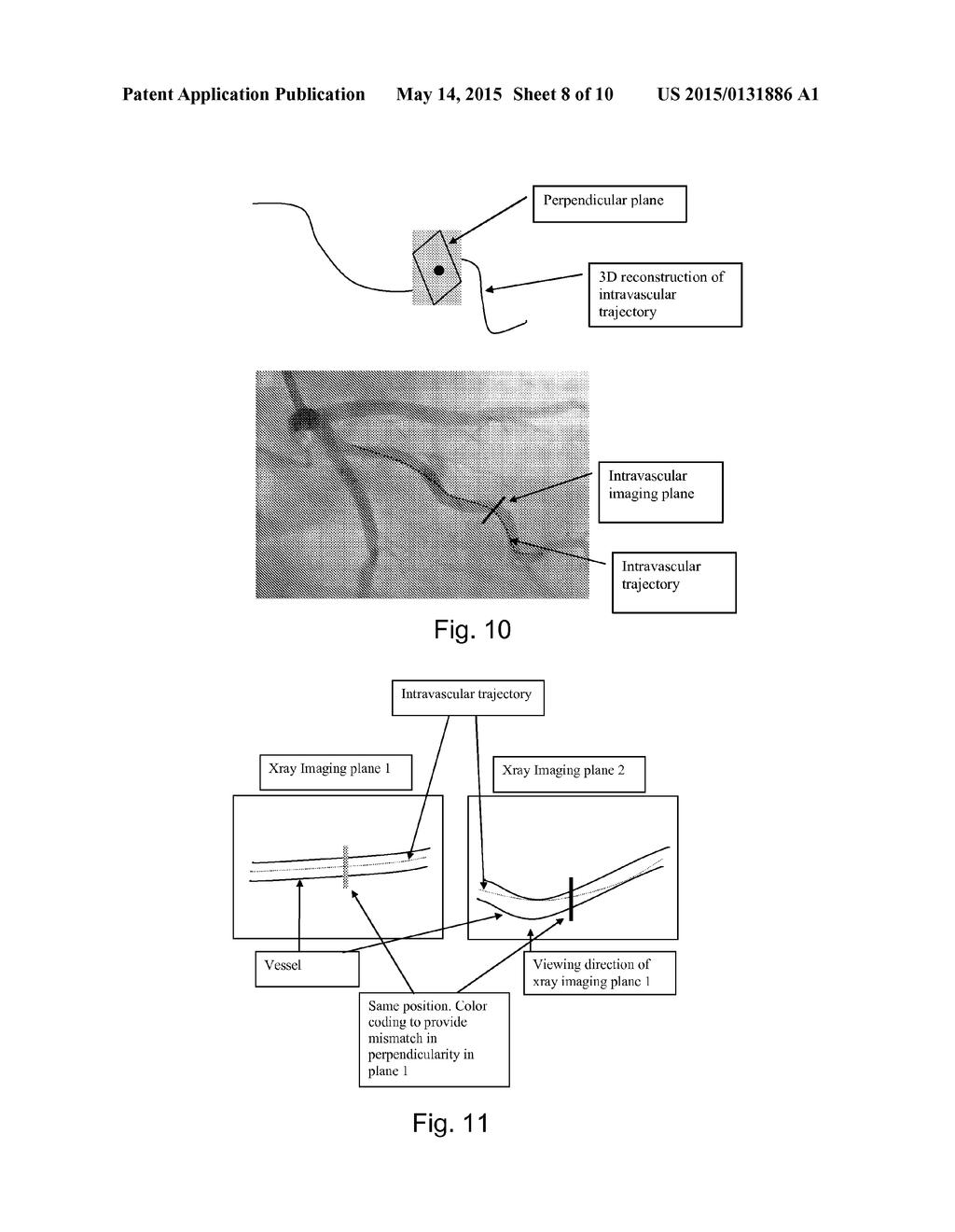 Method and System for Registering Intravascular Images - diagram, schematic, and image 09