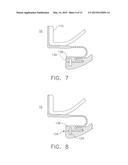 SYSTEM AND METHOD OF LIMITING AXIAL MOVEMENT BETWEEN COMPONENTS IN A     TURBINE ASSEMBLY diagram and image