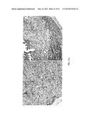 Compositions and Imaging Methods Comprising Detectably Labeled     Phosphatidylethanolamine-Binding Peptides diagram and image