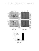 VARIANTS OF TACE PRO-DOMAIN AS TNF-A INHIBITOR AND THEIR MEDICAL USE diagram and image