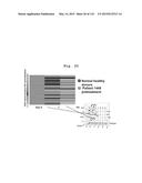 INTERFERON ALPHA-INDUCED PHARMACODYNAMIC MARKERS diagram and image