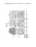 INTERFERON ALPHA-INDUCED PHARMACODYNAMIC MARKERS diagram and image